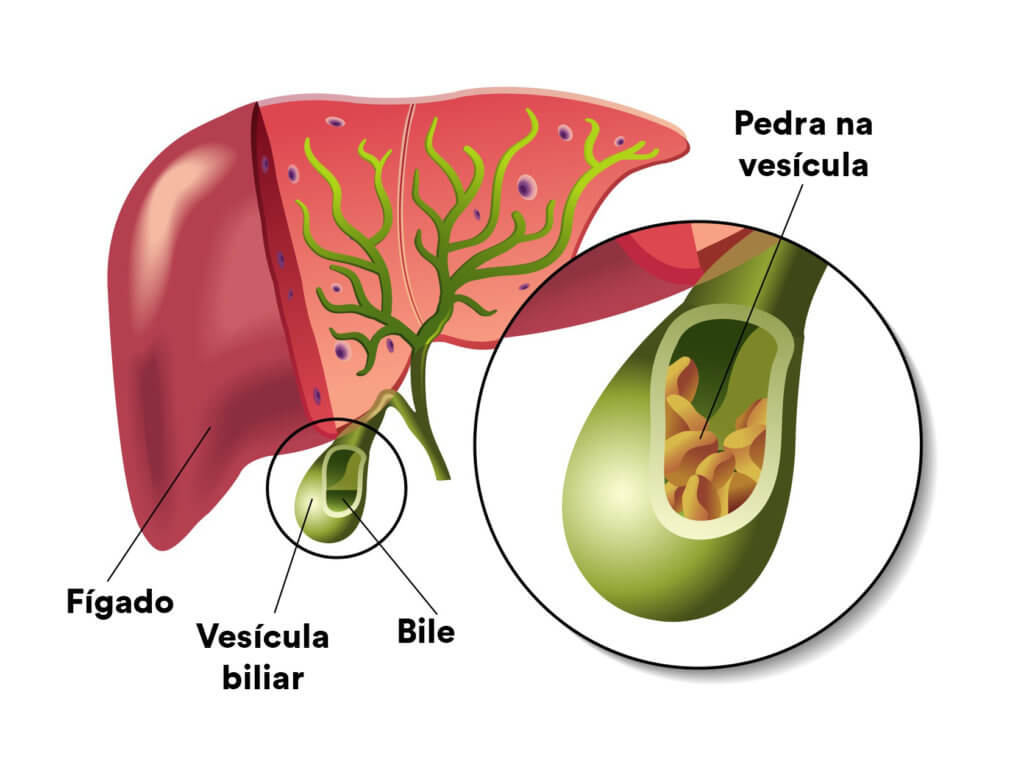Cirurgia Aparelho Digestivo Diego Yuji Ito Cirurgia Aparelho Digestivo Diego Yuji Ito