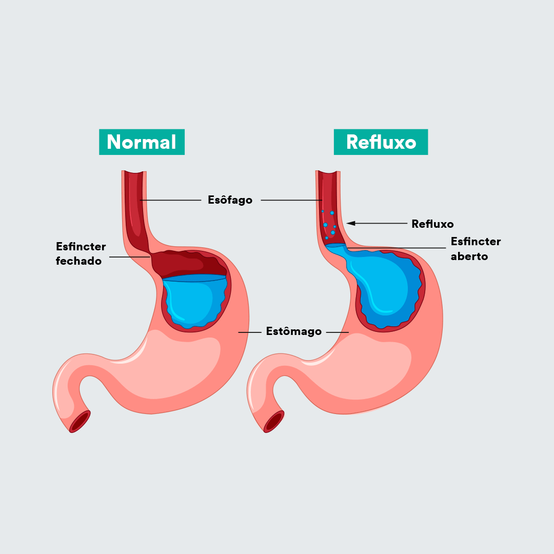 Cirurgia Aparelho Digestivo Diego Yuji Ito Cirurgia Aparelho Digestivo Diego Yuji Ito